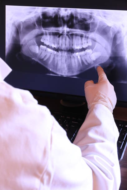 Best Emergency Dentist for Knocked-Out Tooth in Fearrington Village, NC