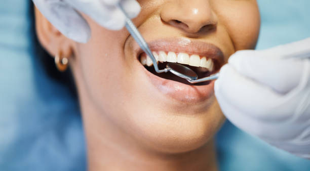 Best Emergency Dental Care for Abscessed Tooth in Fearrington Village, NC