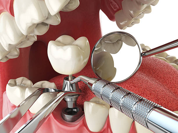 Best Orthodontic Emergency Dentist in Fearrington Village, NC